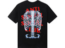 Anti Social Social Club Bones Tee 'Black'