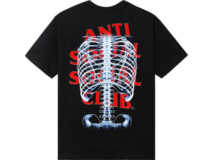 Anti Social Social Club Bones Tee 'Black'