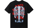 Anti Social Social Club Bones Tee 'Black' - Unmatched Kicks - Anti Social Social Club