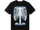 Anti Social Social Club Bones Tee 'Black' - Unmatched Kicks - Anti Social Social Club